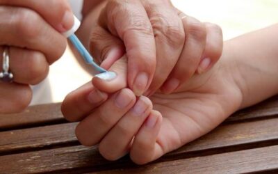 Gdzie leczyć grzybicę paznokci w swoim mieście?