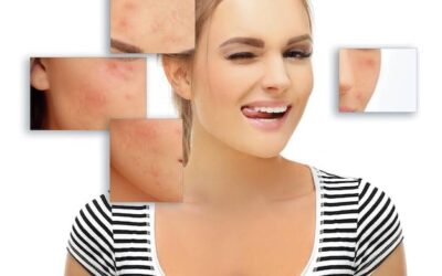 Jak rozpoznać objawy chorób skóry?