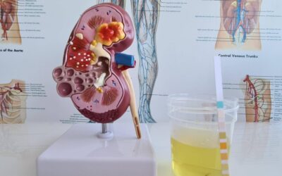 Bakterie w nerkach objawy które powinny wzbudzić niepokój