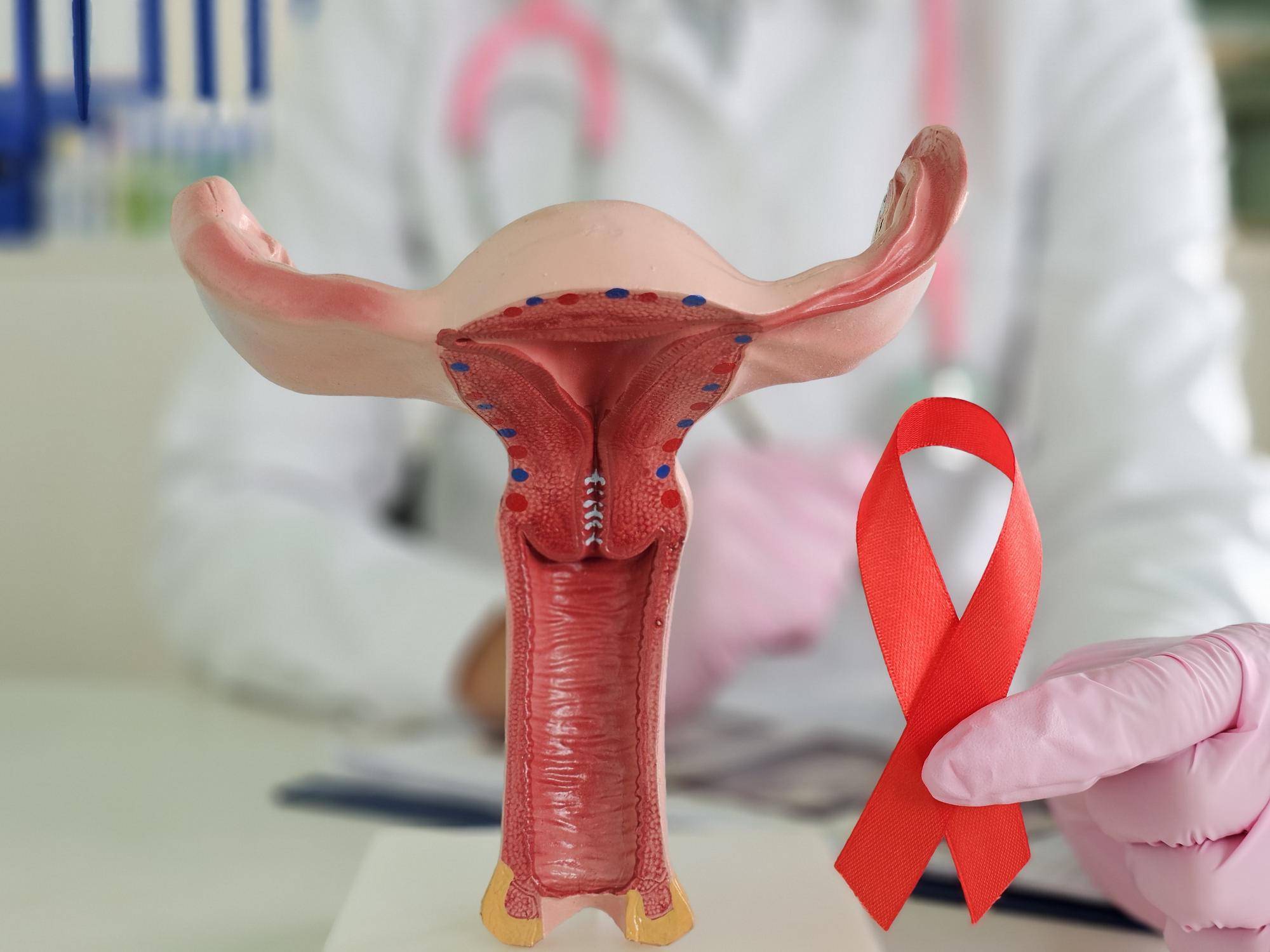 Choroby układu płciowego żeńskiego objawy które mogą zaniepokoić Choroby układu płciowego żeńskiego objawy które mogą zaniepokoić